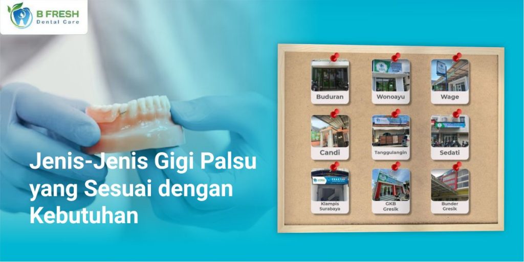 Jenis Jenis Gigi Palsu Yang Sesuai Dengan Kebutuhan