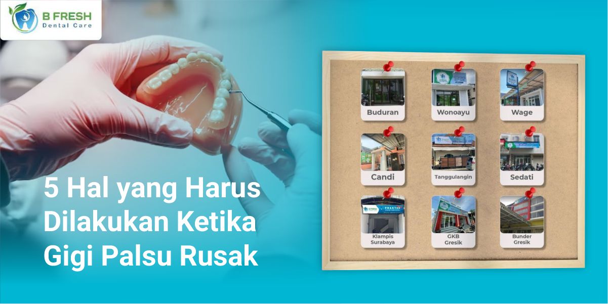 5 Hal Yang Harus Dilakukan Ketika Gigi Palsu Rusak