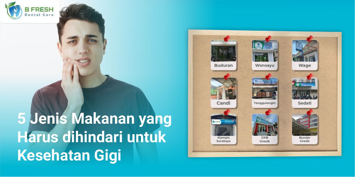 5 Jenis Makanan Yang Harus Dihindari Untuk Kesehatan Gigi
