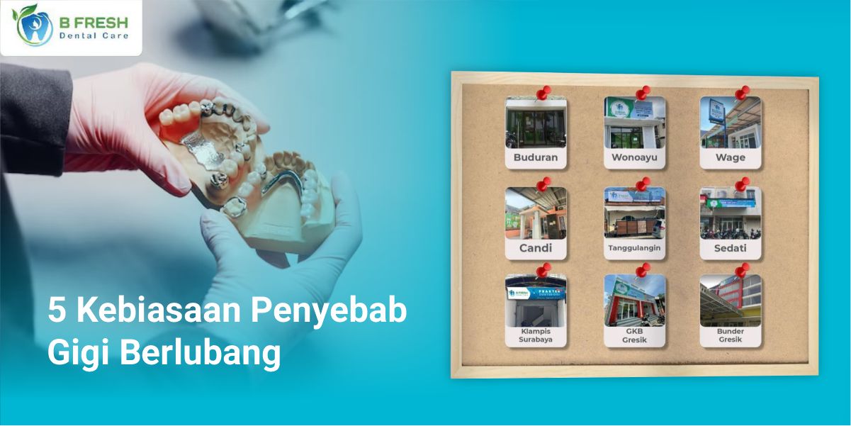 5 Kebiasaan Penyebab Gigi Berlubang