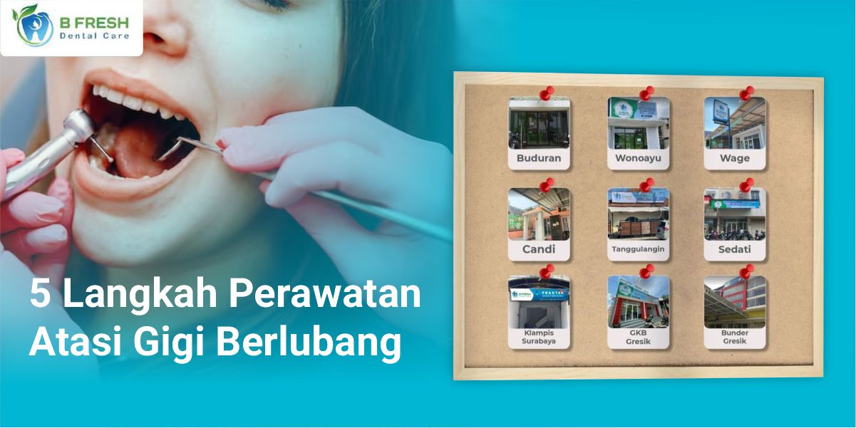 5 Langkah Perawatan Atasi Gigi Berlubang