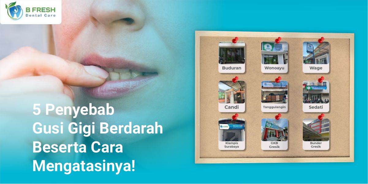 5 Penyebab Gusi Gigi Berdarah Beserta Cara Mengatasinya