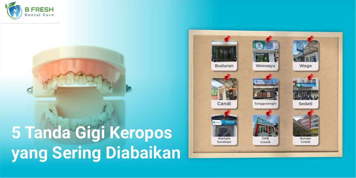 5 Tanda Gigi Keropos Yang Sering Diabaikan