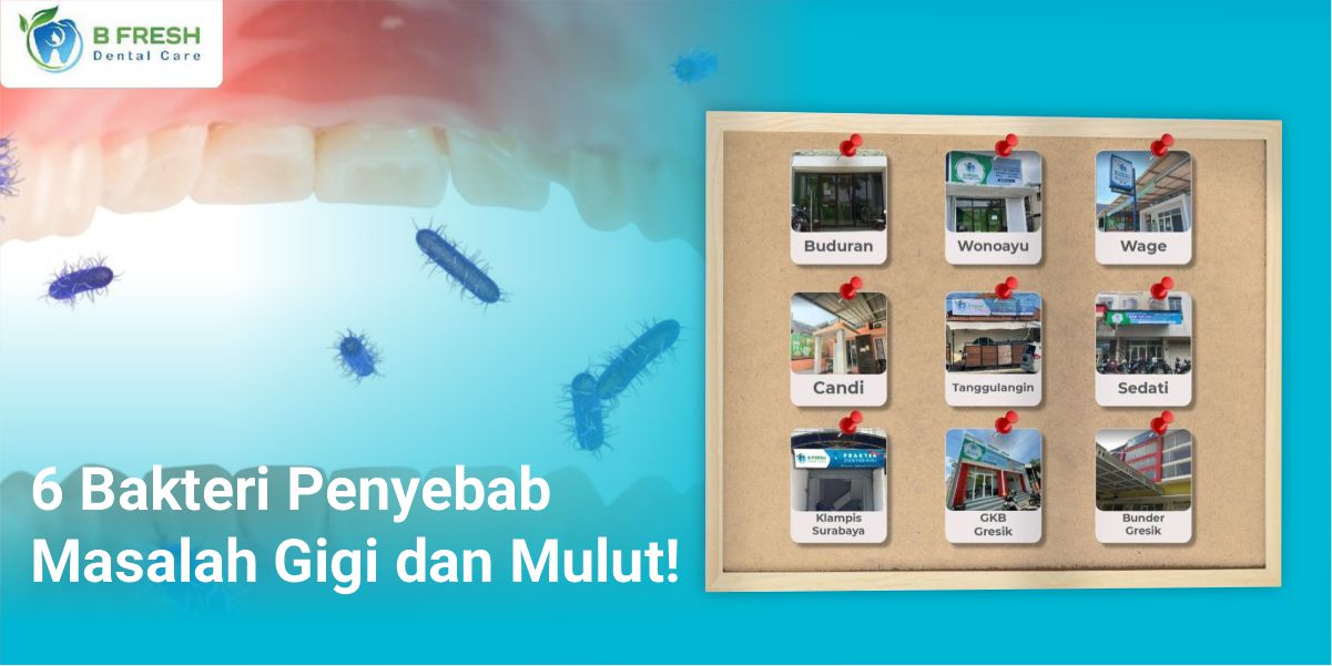 6 Bakteri Penyebab Masalah Gigi Dan Mulut!