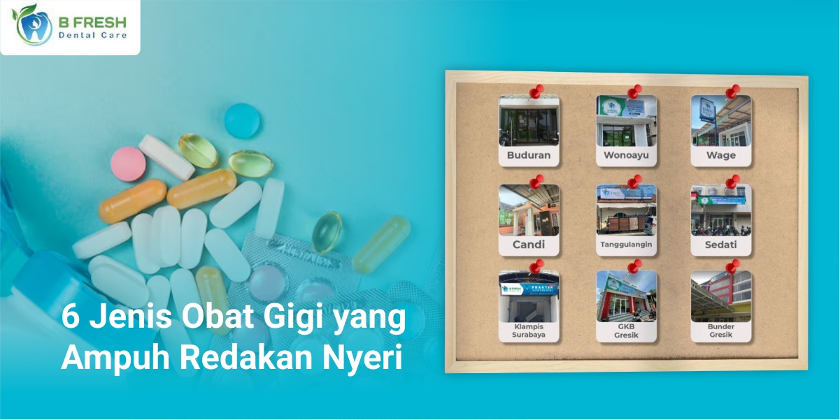 6 Jenis Obat Gigi Yang Ampuh Redakan Nyeri