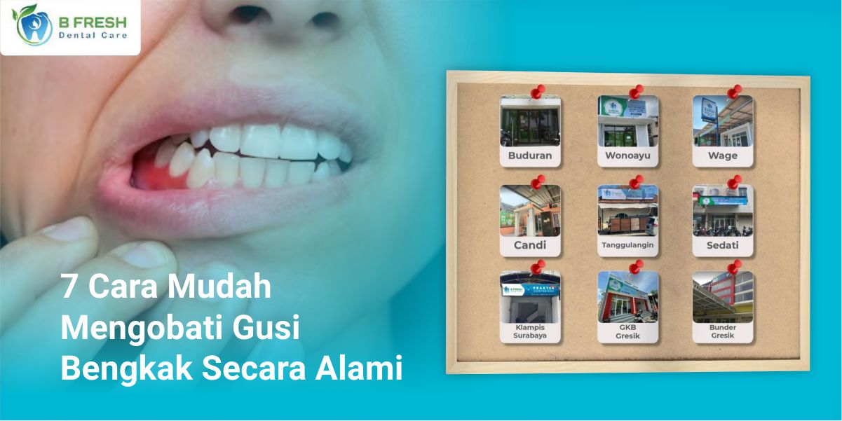 7 Cara Mudah Mengobati Gusi Bengkak Secara Alami