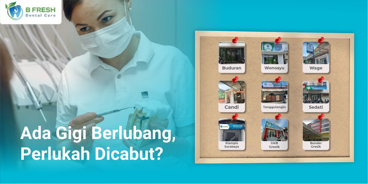 Ada Gigi Berlubang, Perlukah Dicabut?