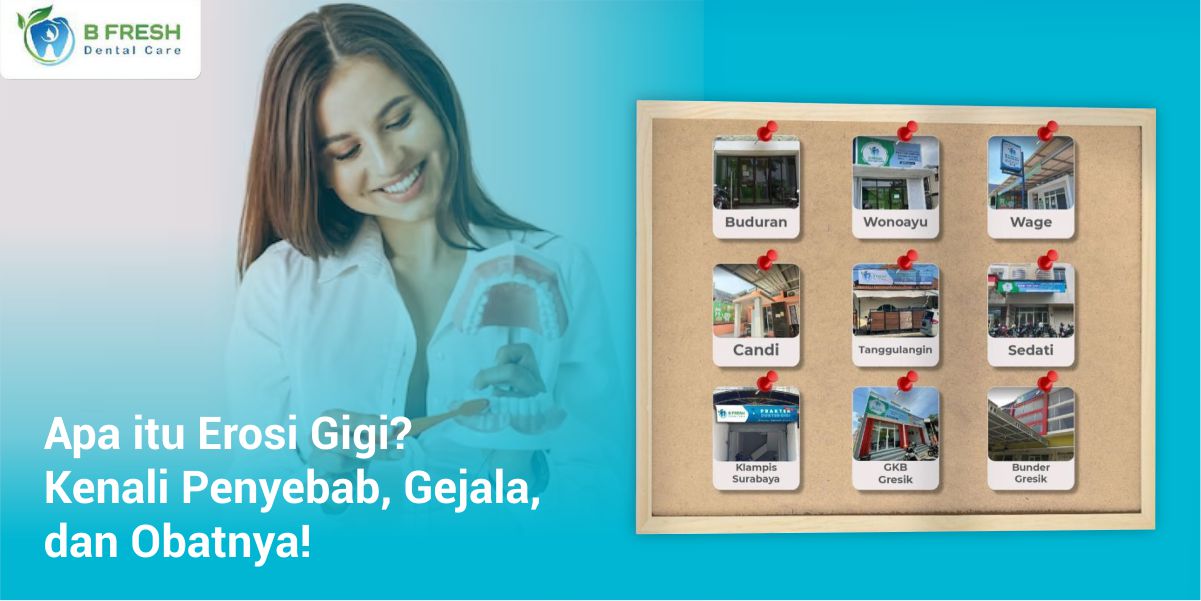 Apa Itu Erosi Gigi? Kenali Penyebab, Gejala, Dan Obatnya!