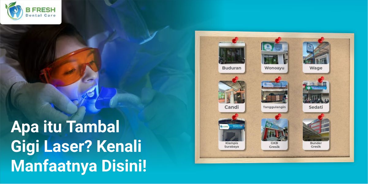 Apa Itu Tambal Gigi Laser? Kenali Manfaatnya Disini!
