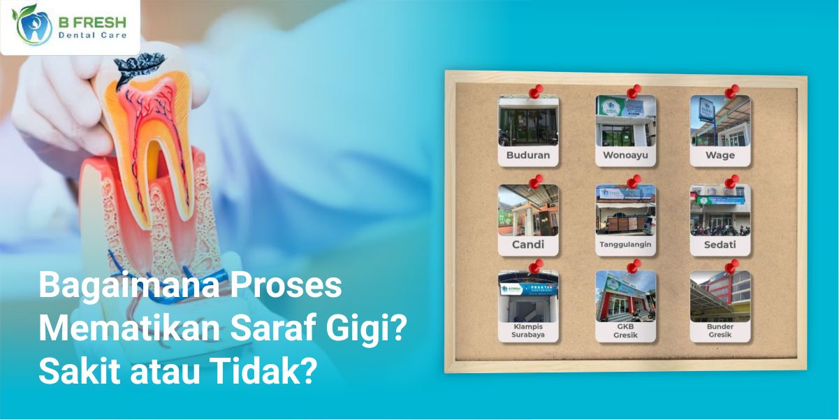 Bagaimana Proses Mematikan Saraf Gigi? Sakit Atau Tidak?
