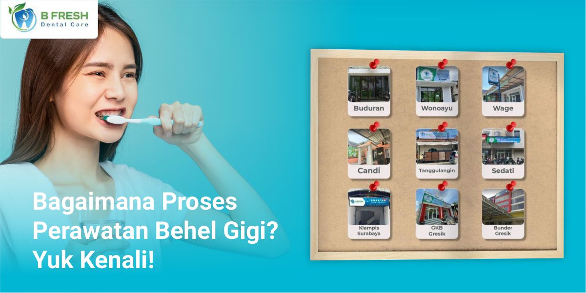 Bagaimana Proses Perawatan Behel Gigi? Yuk Kenali!