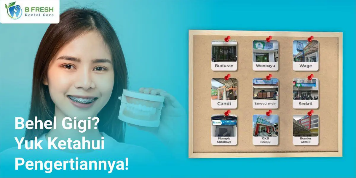 Behel Gigi? Yuk Ketahui Pengertiannya!