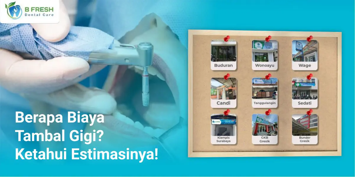 Berapa Biaya Tambal Gigi? Ketahui Estimasinya!