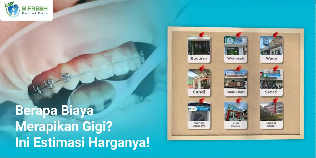 Berapa Biaya Merapikan Gigi? Ini Estimasi Harganya!