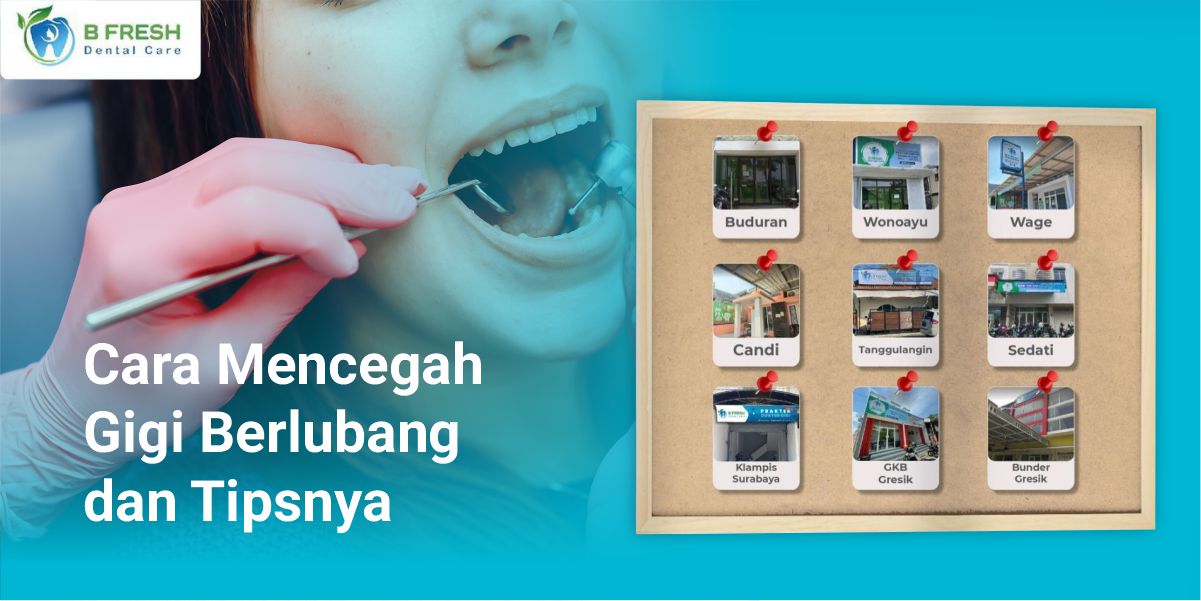 Cara Mencegah Gigi Berlubang Dan Tipsnya