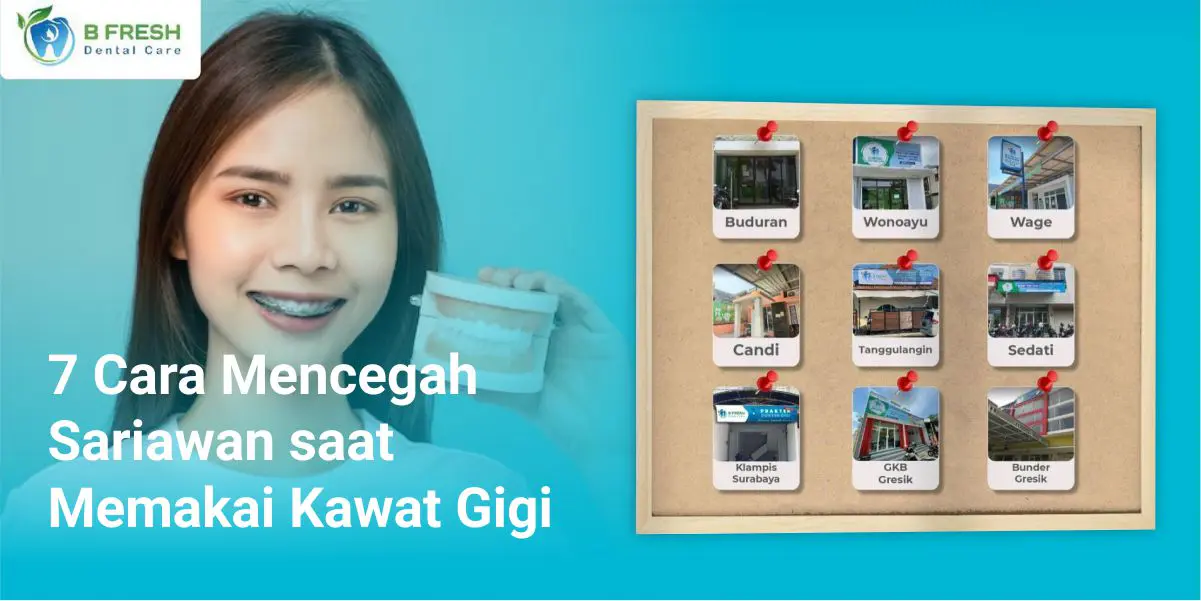 4 Cara Mencegah Sariawan Saat Memakai Kawat Gigi