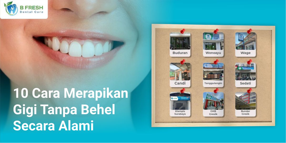 6 Cara Merapikan Gigi Tanpa Behel
