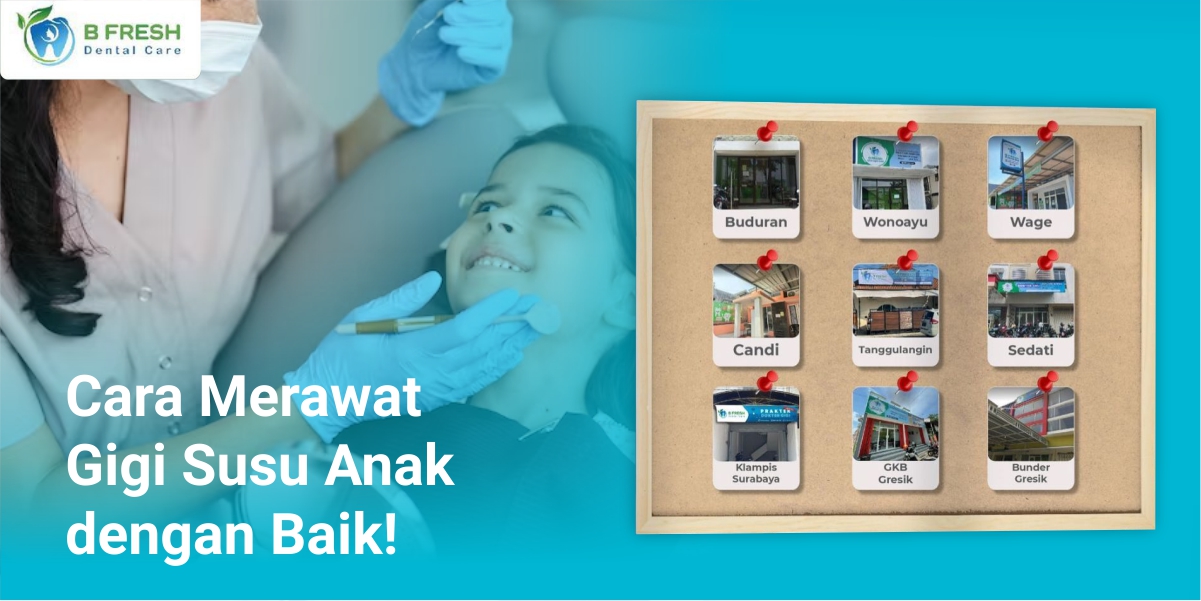 Cara Merawat Gigi Susu Anak Dengan Baik!
