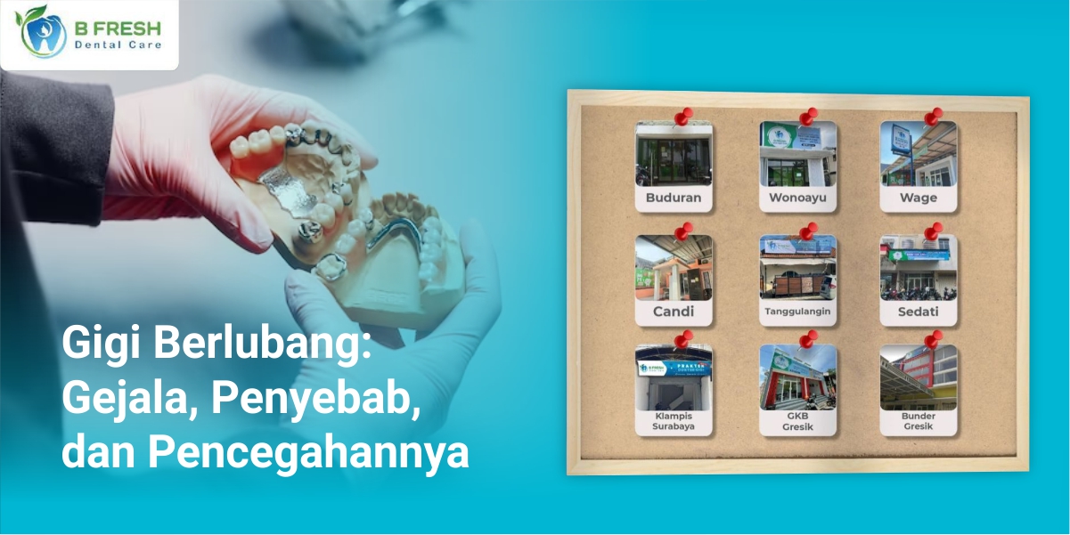 Gigi Berlubang: Gejala, Penyebab, Dan Pencegahannya