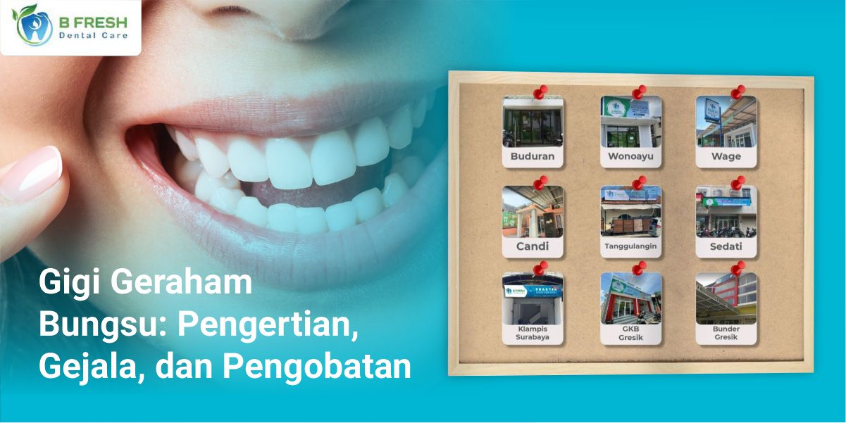 Gigi Geraham Bungsu: Pengertian, Gejala, Dan Pengobatan