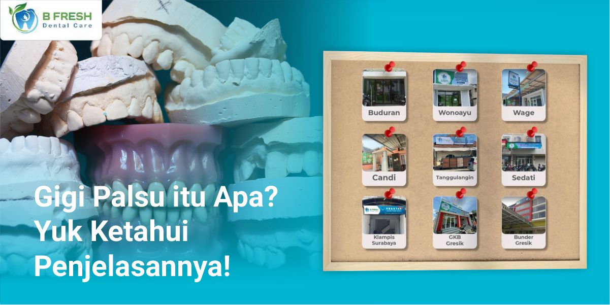 Gigi Palsu Itu Apa? Yuk Ketahui Penjelasannya!