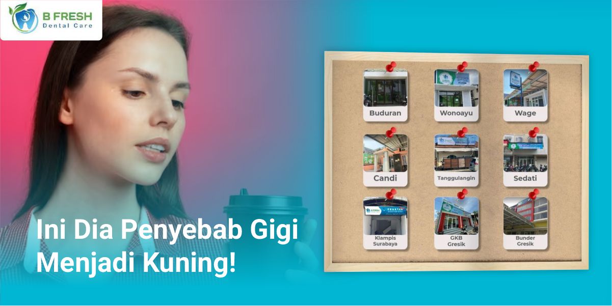 Ini Dia Penyebab Gigi Menjadi Kuning!