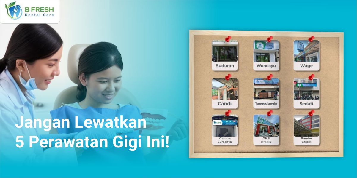 Jangan Lewatkan 5 Perawatan Gigi Ini!