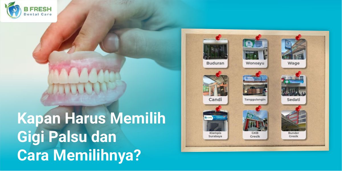 Kapan Harus Memilih Gigi Palsu Dan Cara Memilihnya?