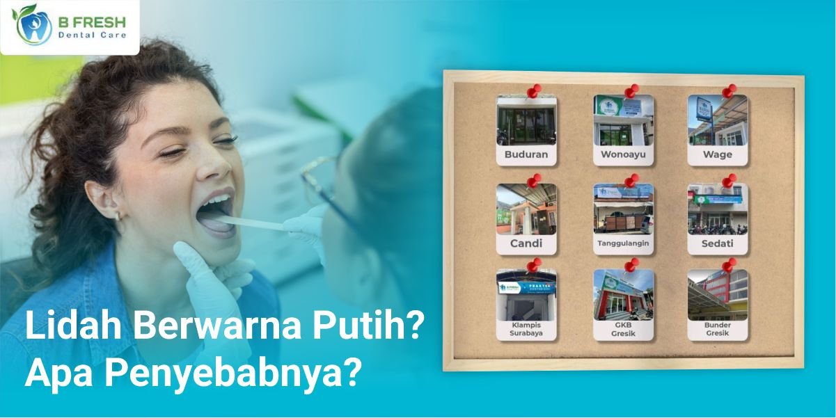 Lidah Berwarna Putih? Apa Penyebabnya?
