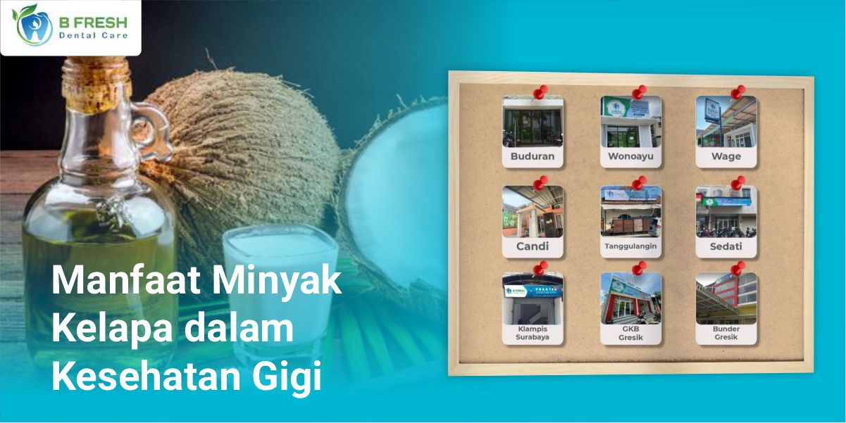 Manfaat Minyak Kelapa Dalam Kesehatan Gigi