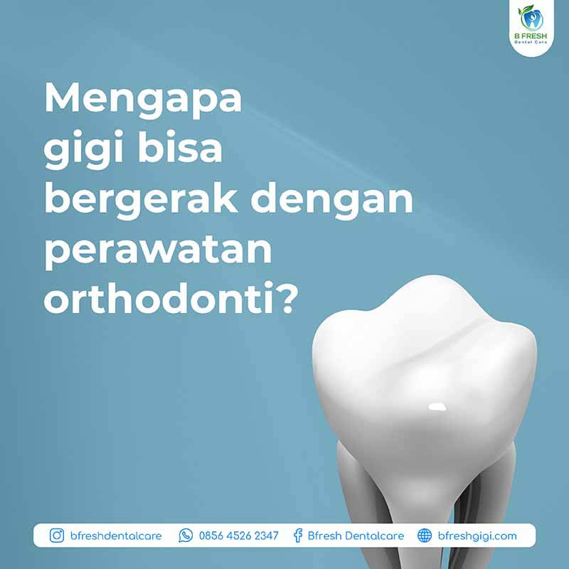 Mengapa Gigi Bisa Bergerak Dengan Perawatan Orthodonti?