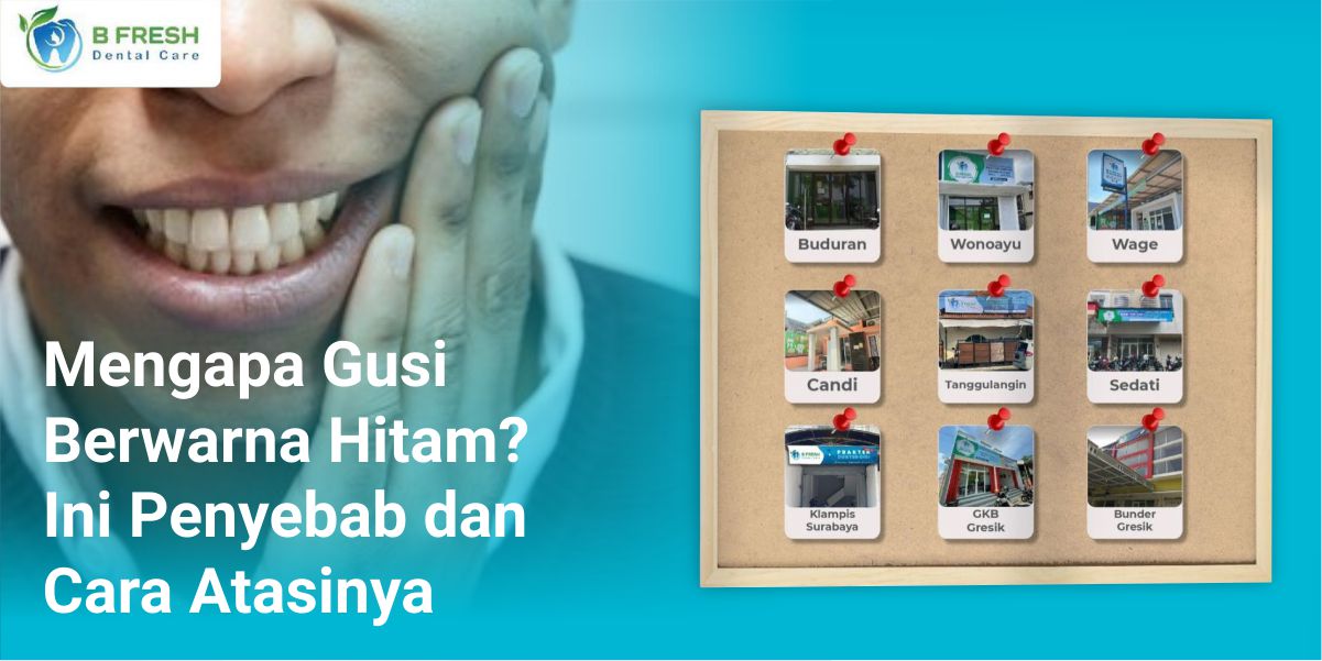 Mengapa Gusi Berwarna Hitam? Ini Penyebab Dan Cara Atasinya