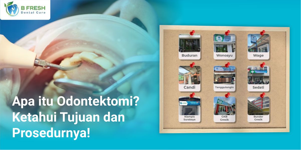 Apa Itu Odontektomi? Ketahui Tujuan Dan Prosedurnya!