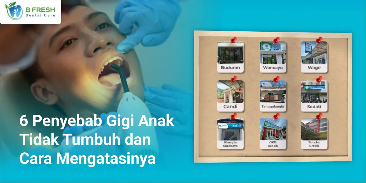 6 Penyebab Gigi Anak Tidak Tumbuh Dan Cara Mengatasinya