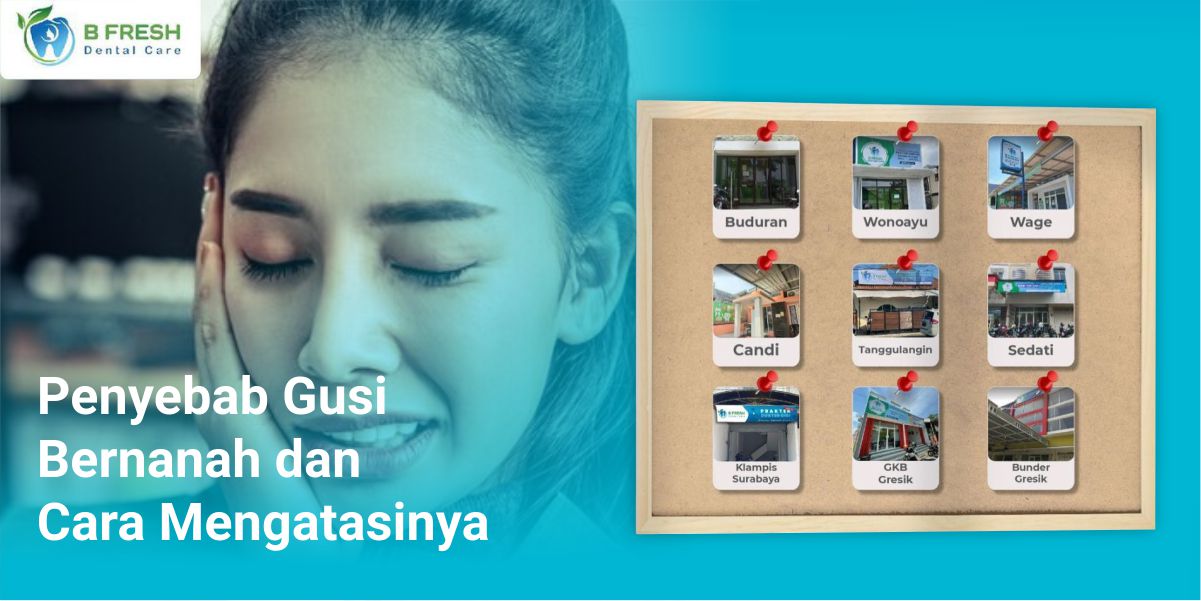 Penyebab Gusi Bernanah Dan Cara Mengatasinya