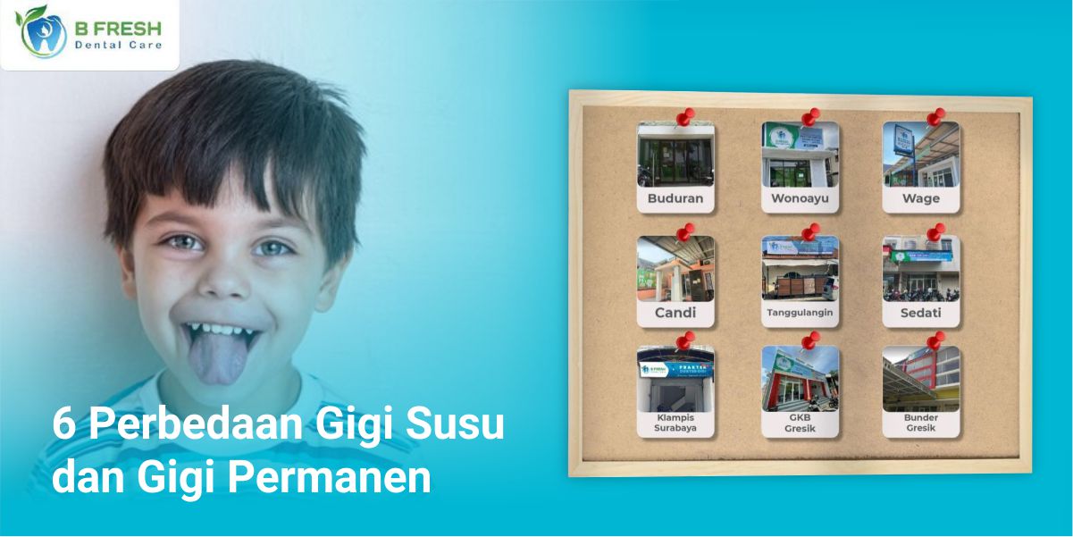 6 Perbedaan Gigi Susu Dan Gigi Permanen