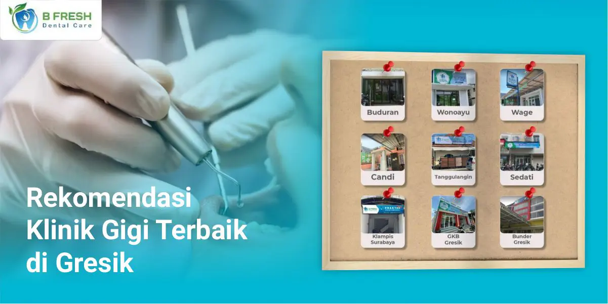 Rekomendasi Klinik Gigi Terbaik Di Gresik