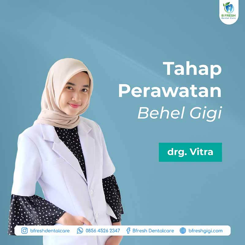 Tahap Perawatan Behel Gigi