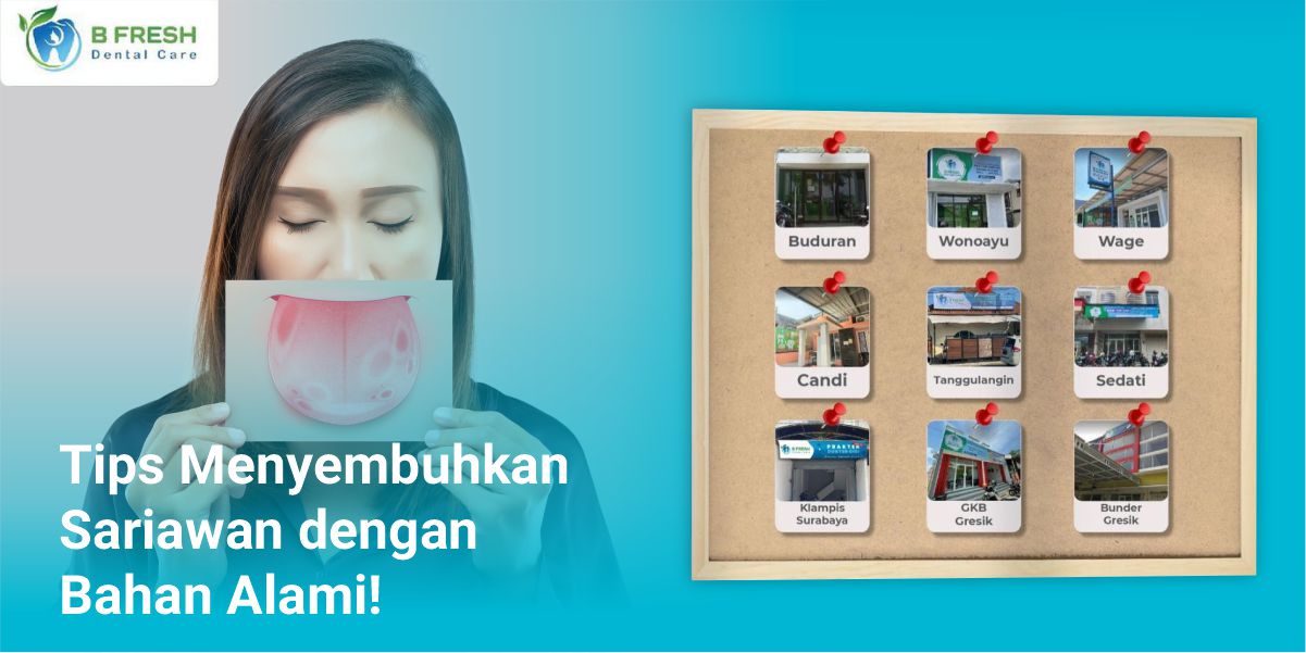 Tips Menyembuhkan Sariawan Dengan Bahan Alami!