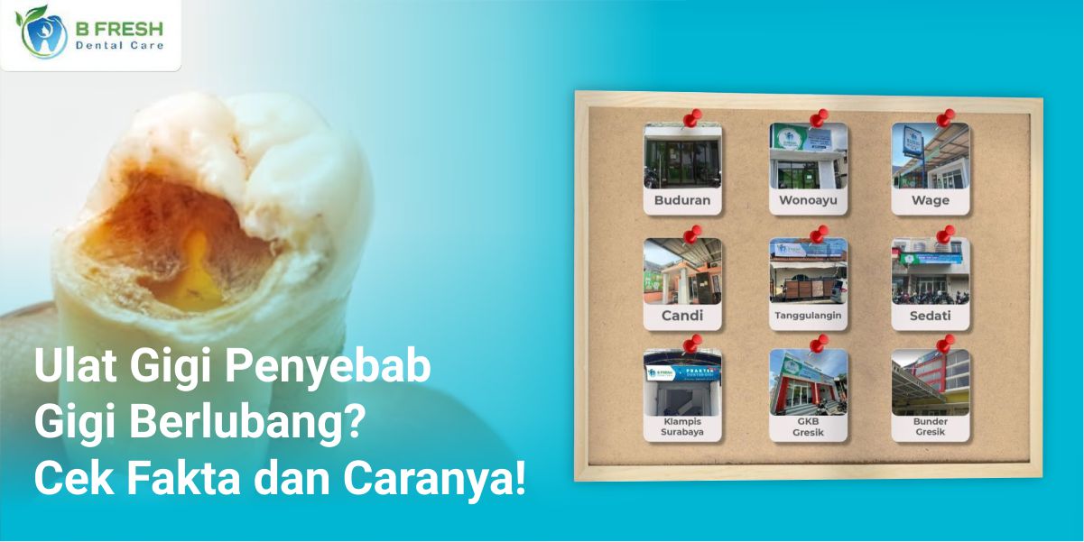 Ulat Gigi Penyebab Gigi Berlubang? Cek Fakta Dan Caranya!