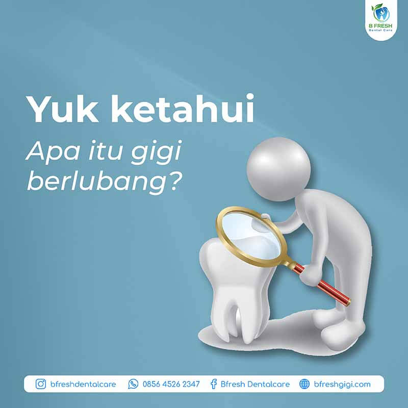 Yuk Ketahui Apa Itu Gigi Berlubang