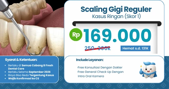 Promo Scaling Gigi Regular (Kasus Ringan)