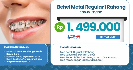 Promo Behel Metal Regular
