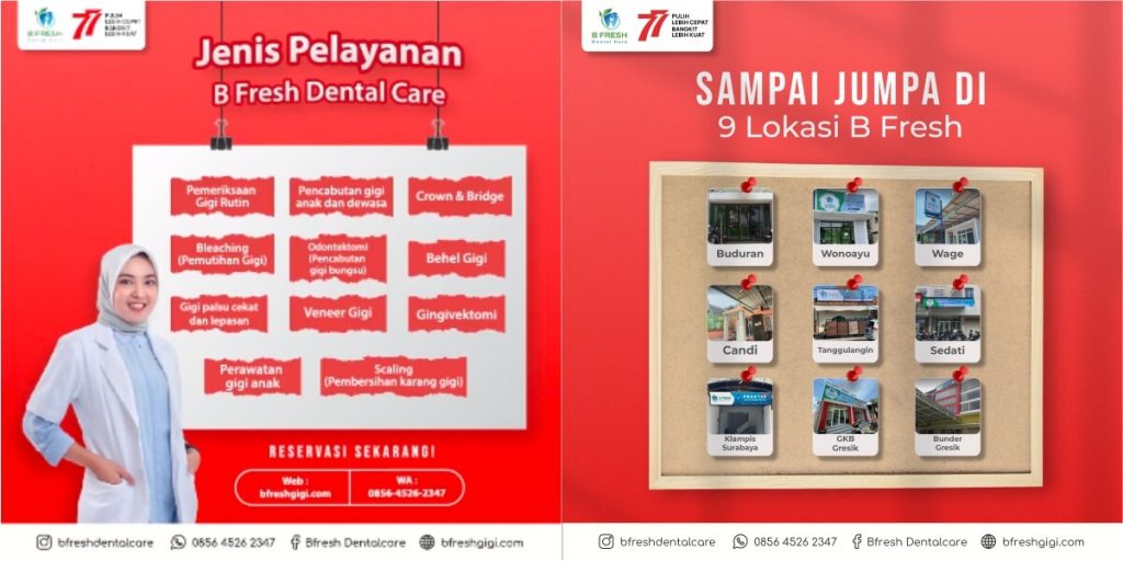 Jenis Pelayanan B Fresh Dental Care Bfresh Dental Care