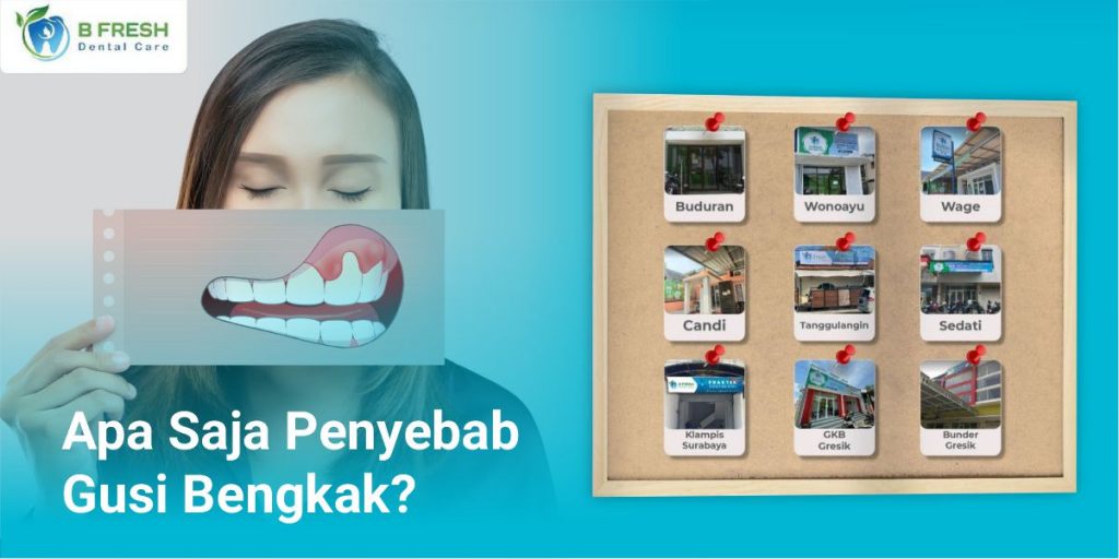 Apa Saja Penyebab Gusi Bengkak? - Bfresh Dental Care