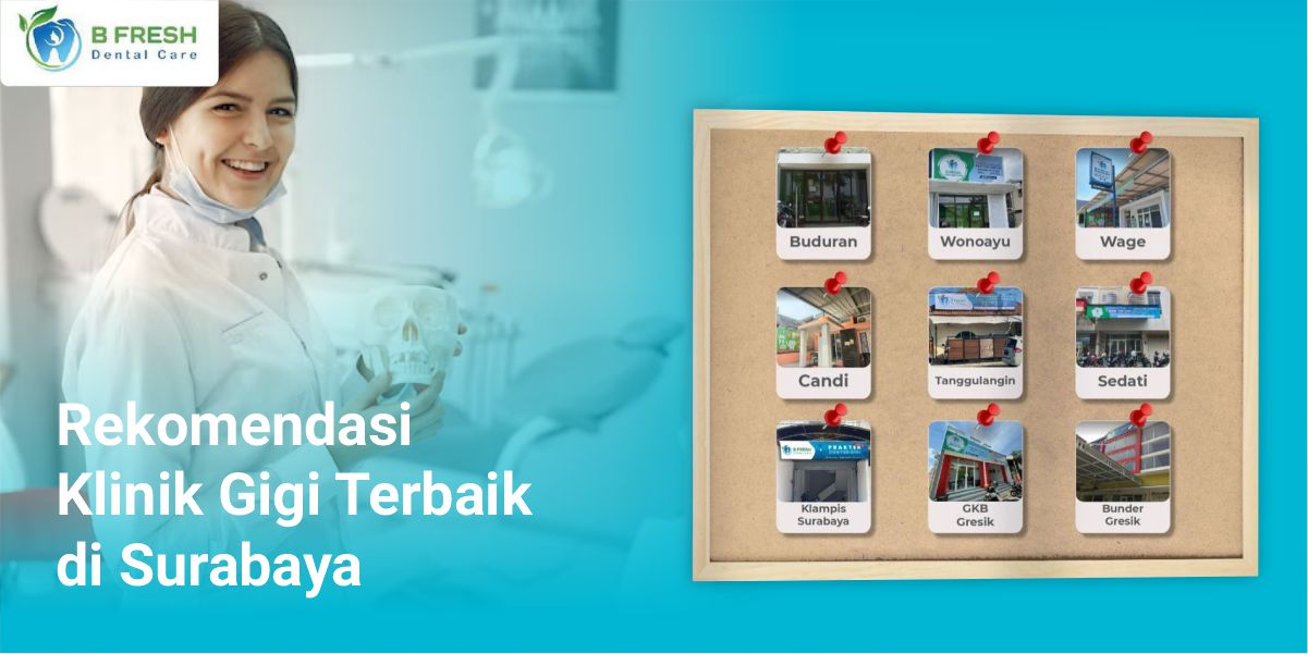 Rekomendasi Klinik Gigi Terbaik di Administrasi Jakarta Selatan