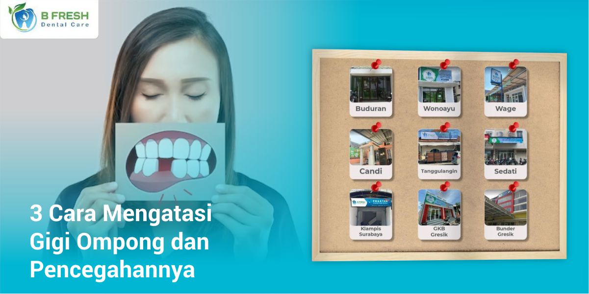 3 Cara Mengatasi Gigi Ompong dan Pencegahannya