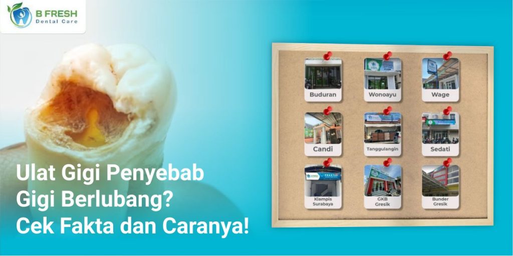 Ulat Gigi Penyebab Gigi Berlubang? Cek Fakta Dan Caranya!