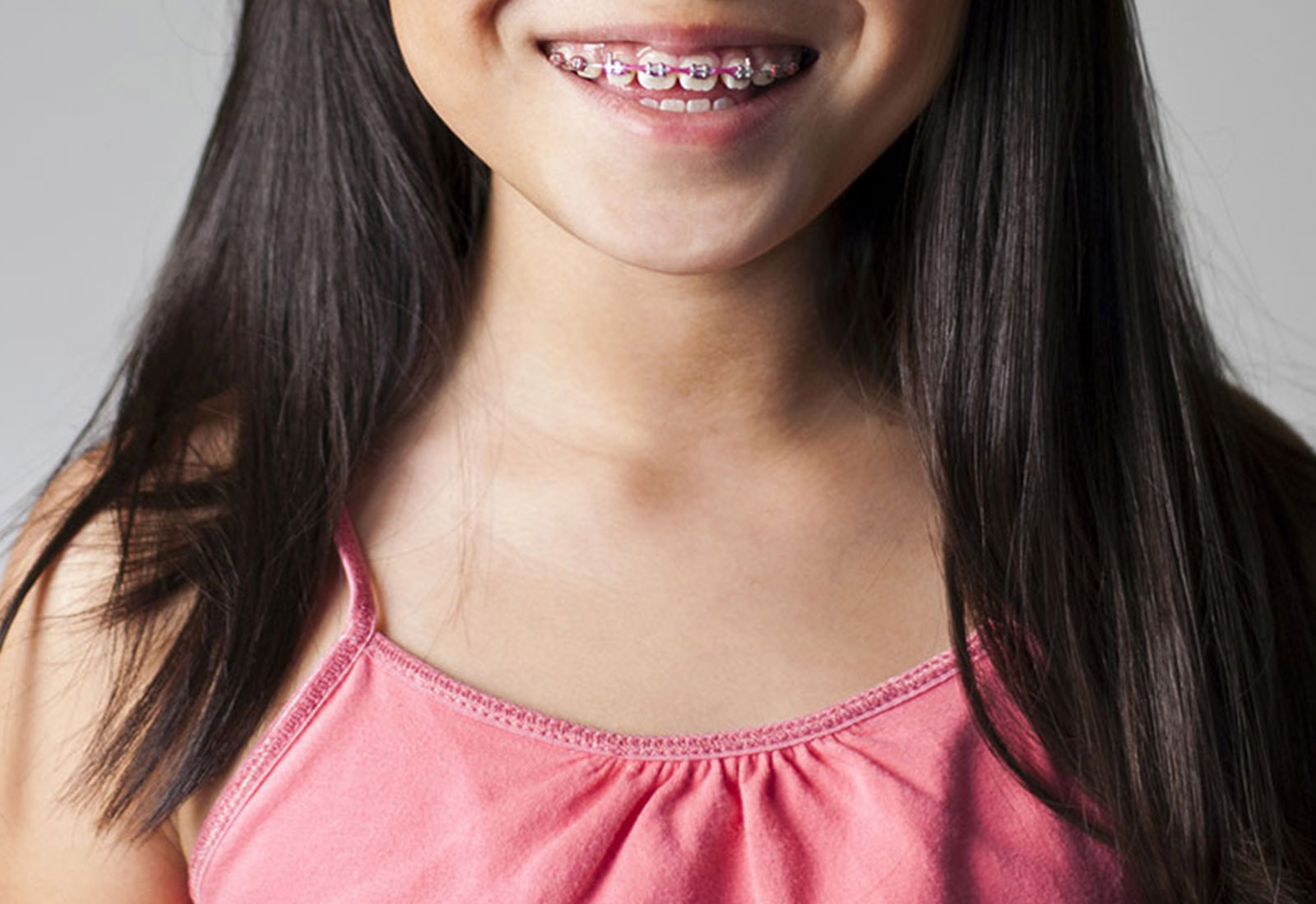 Panduan Lengkap Perawatan Ortodontik untuk Anak