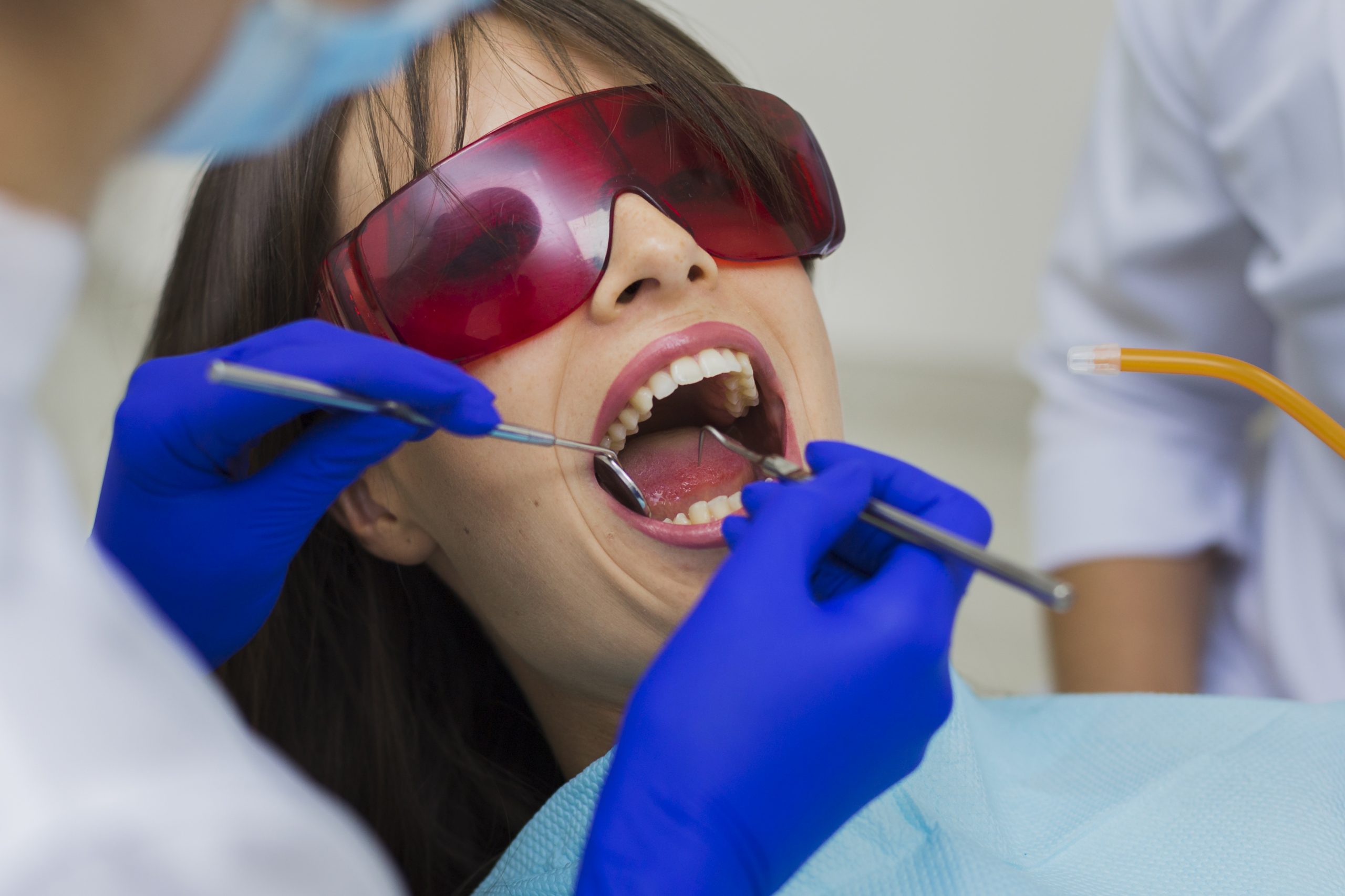 Manfaat Membersihkan Karang Gigi di Klinik Dokter Gigi